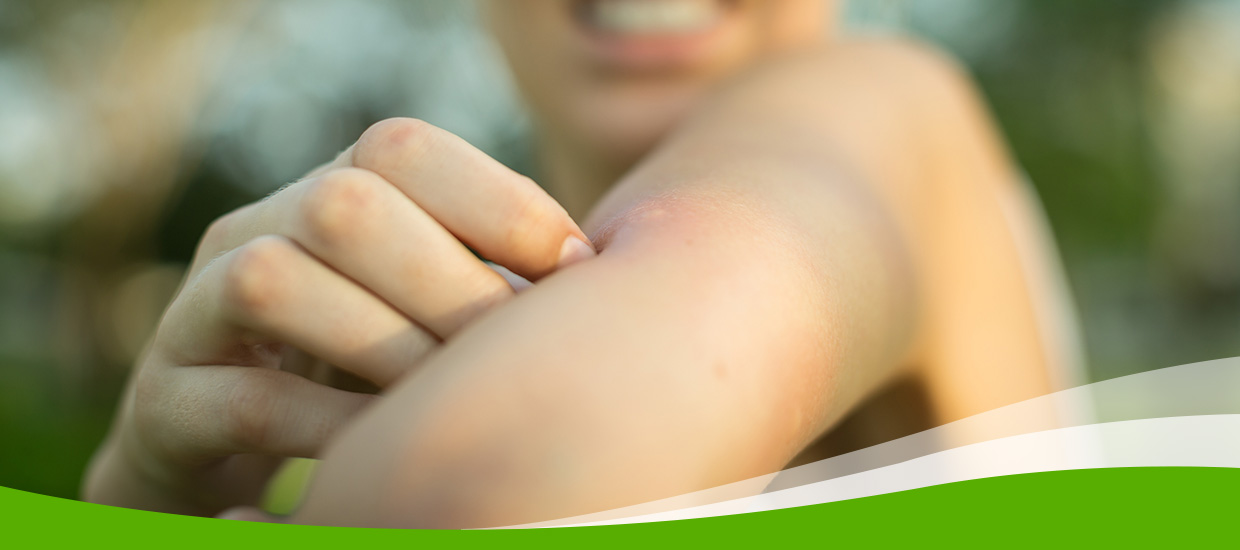 human arm with mosquito bite